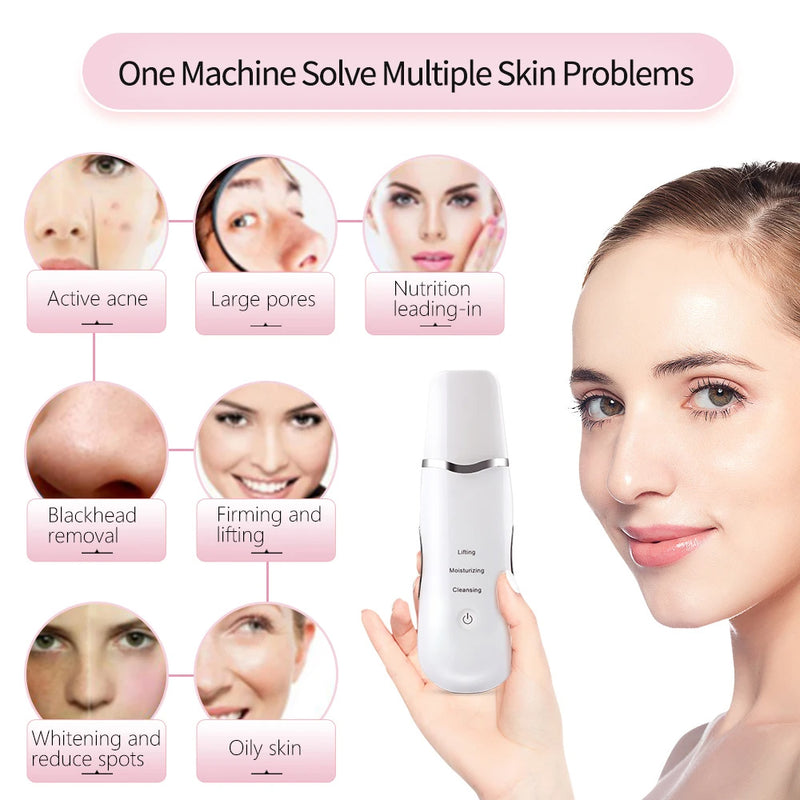 3-in-1 Ultrasonic Facial Spatula For Deep Cleansing, Electric Ultrasonic Skin Scrubber 5