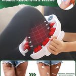 ONUEMP Cellulite Remover for Legs, Cellulite Massager Roller Muscle Roller, Fascia Massage Tool Thigh, Calf, Leg Massager - Anti-Celulitis, Lymphatic Drainage, Body Sculpting, Deep Tissue Pain Relief 8