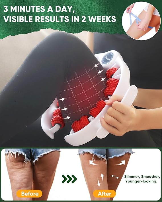 ONUEMP Cellulite Remover for Legs, Cellulite Massager Roller Muscle Roller, Fascia Massage Tool Thigh, Calf, Leg Massager - Anti-Celulitis, Lymphatic Drainage, Body Sculpting, Deep Tissue Pain Relief 8