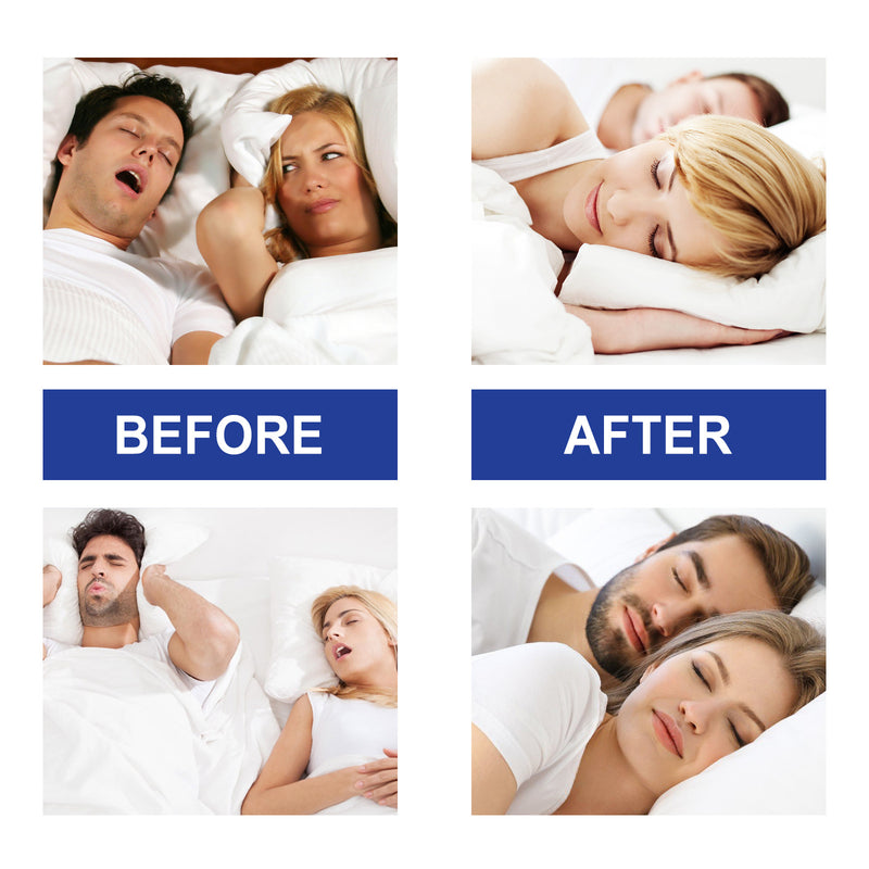 Sleep Stickers Relieve Mouth Breathing Anti-snoring Care Sleep 9