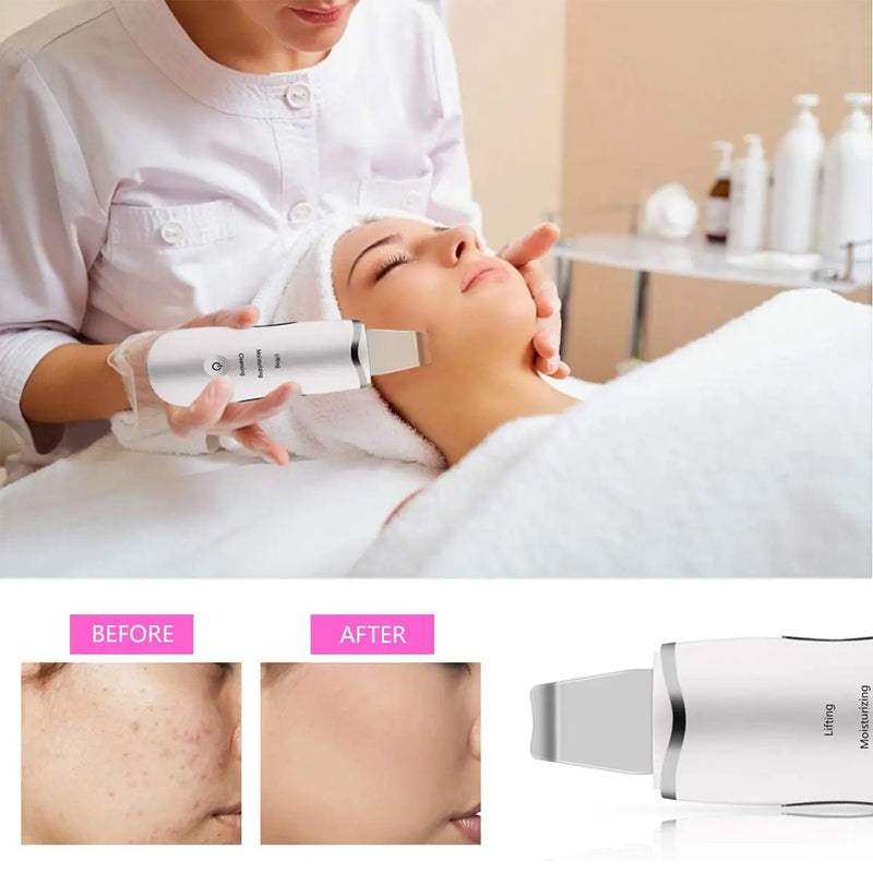 3-in-1 Ultrasonic Facial Spatula For Deep Cleansing, Electric Ultrasonic Skin Scrubber 6